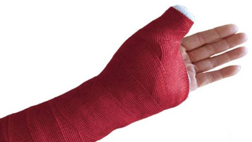 مزیت‌ های باند فایبرگلاس نسبت به گچ معمولی