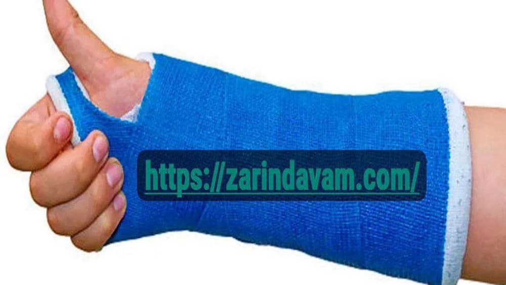 تولید باند فایبرگلاس ارتوپدی