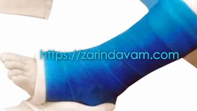 تولید باند فایبرگلاس ارتوپدی